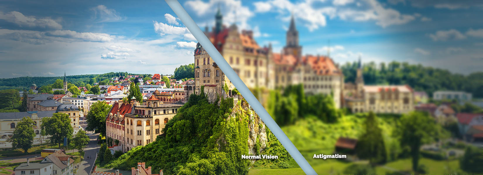 Astigmatism Treatment in Fort Worth