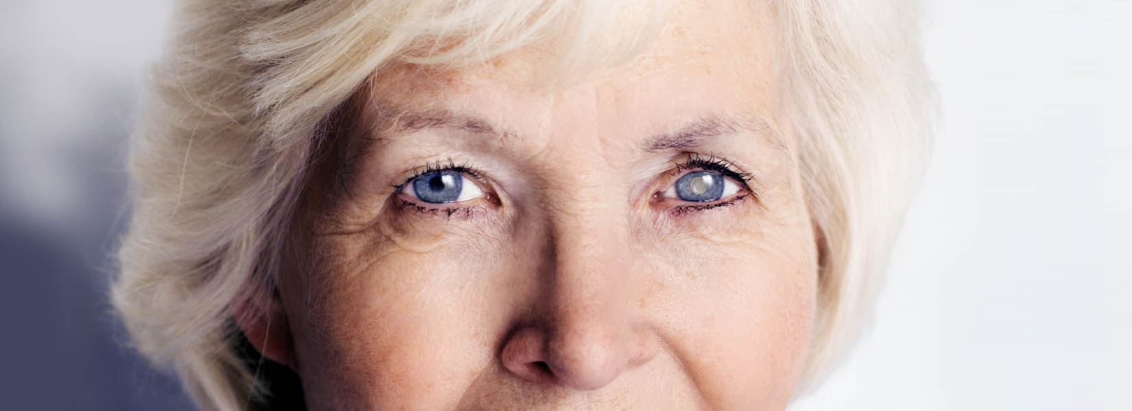 Cataract Surgery in Fort Worth
